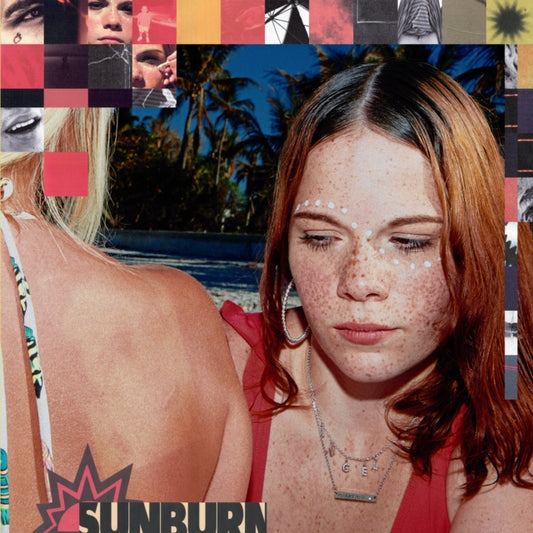 DOMINIC FIKE / SUNBURN